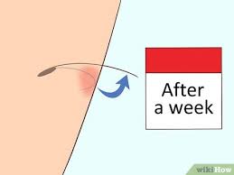 Add salt to the water and mix well. 3 Ways To Remove An Ingrown Hair Wikihow