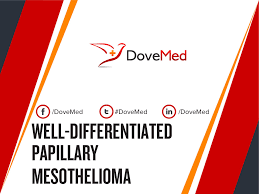 Adenocarcinoma) thus panel of immunohistochemical markers is generally required. Well Differentiated Papillary Mesothelioma