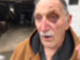 Maine fox attacks surge in the Midcoast with more than half a dozen in just  6 months