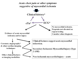 Ecg diagnosis of mi is more difficult when a left bundle branch block configuration is present for patients with nstemi: Diagnosing Type 2 Myocardial Infarction American College Of Cardiology