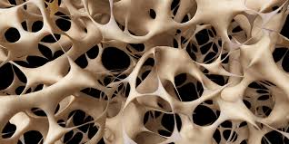 See more ideas about microscopic, plant cell, microscopic. Learn What Osteoporosis Is And What It S Caused By