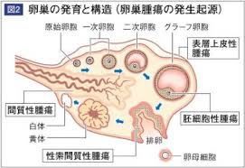 「卵巣がん 原因」の画像検索結果