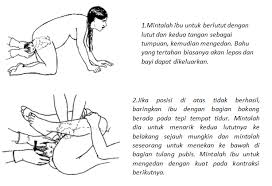 Gerakan ini tidak boleh terlalu keras apalagi memaksa bayi menekuk lututnya. Apa Yang Harus Dilakukan Apabila Bahu Bayi Tidak Bisa Dikeluarkan Distosia Bahu Kebidanan Dictio Community