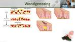 Biologie klas 2 - De huid: anatomie, lichaamstemperatuur en ... - YouTube
