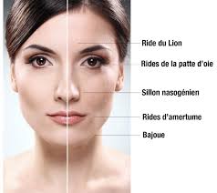 Lors d'un mouvement spastique, l'œil situé du coté atteint se referme alors que le coin de la bouche se soulève. Medecine Anti Age Injections De Botox A Lausanne Vevey