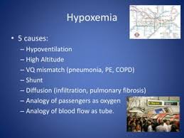 Image result for A-a Gradient