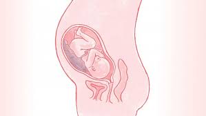 Anterior Placenta What It Means For You And Your Baby