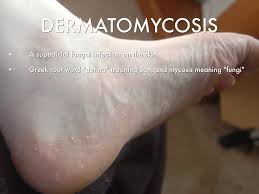 Onkos means lump, mass and tumor and logy. Oncology By Sidney Collier