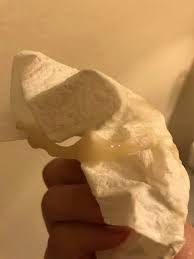 According to emedicine health, you may notice an increase in vaginal discharge, which is related to the shifting of hormones that helps prepare your body for labor.some women notice a light, bloody mucus that usually indicates that the cervix, the lower section of the uterus, is opening and thinning out. Mucus Plug 101 Who What Where When Why With Photos