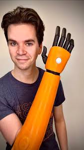 Lucky Fin 3D printed bionic hand for the Win!