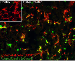 In some instances, capsaicin may even be able to kill cancer cells. Fighting Cancer With Cancer An Out Of The Box Approach