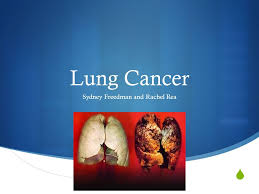 About 2,900 of these deaths occur among people who have never smoked. Lung Cancer Sydney Freedman And Rachel Rea Causes No Exact Cause Smokers And Non Smokers Can Get Lung Cancer Smoke Causes Cancer By Damaging Ppt Download