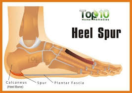 Pin On Foot Pain