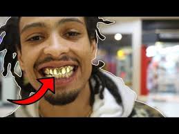 The total cost can be broken down as follows: Are Gold Teeth Safe Advantages Disadvantages To Using Gold In Your Mouth
