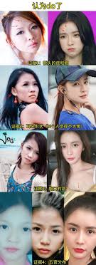 The division of plastic and reconstructive surgery at children's hospital of philadelphia (chop) is among the largest, most active children's plastic surgery centers in the united states. Cai Zhuoyi S Old Photos Flowed Out With The Same Style Of Pork Chop Face As Baby Facelift Changed Face To Be A Fairy Daydaynews