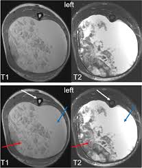 Image result for Pseudoeriosema