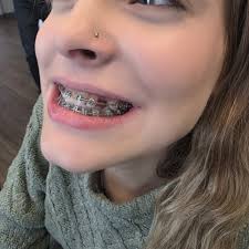 TOP 10 BEST Orthodontists near Nashville, NC