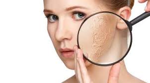 6 Langkah Mengatasi Kulit Kering Dan Terkelupas Beauty Fimela Com