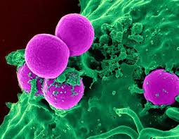 Image result for Striga baumannii