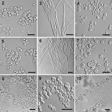 Image result for Buchnera candida