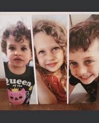 הזרקות יופי ומילוי קמטים ד"ר ללי לוי /Dr.LALI LEVI/dentist