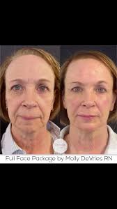 Yes these results can be achieved without surgery and