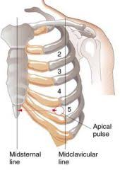 Image result for Point of Maximum Impulse