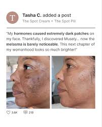 The new wave of anti-aging is here! ✨ The Aging Repair Cream is our NEW  estrogen-based prescription anti-aging cream that plumps the skin, restores  elasticity, shrinks pores, and improves dryness and dullness. "