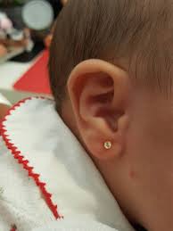 Read on to know when to pierce baby's ears, who should pierce baby's ears and how to prepare yourself and your baby for ear piercing ceremony. Ear Piercing My Family Clinic