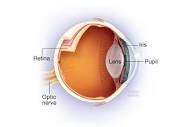 Optic neuritis - Symptoms & causes - Mayo Clinic