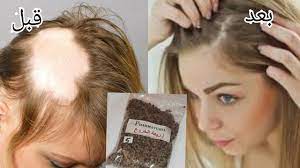 ضعيها لفراغات شعرك و الصلع وأقسم بالله النتيجة ستبهرك تنبت الشعر وتملأ فراغات الراس traitement maison pour cheveux faire pousser les cheveux pousse des cheveux