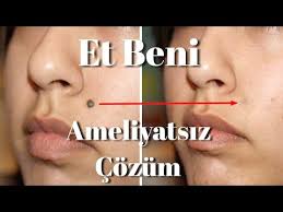 Et Beni Dusurme Kesin Cozum Tedavi Yontemleri Youtube