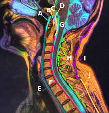 The ligamentum nuchae go from two places on or near the back of your skull and extend through all of the cervical (neck) spinous processes. Nuchal Ligament Wikiwand