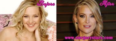 We did not find results for: Kate Hudson Plastic Surgery Before After Picture