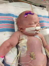 Learn about herpes, a contagious infection caused by herpes simplex virus (hsv). Mum S Harrowing Warning As Newborn Baby Dies From Herpes At 8 Days Old