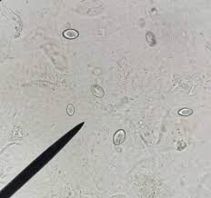 Pin By Noble On Cristales Urinarios Science
