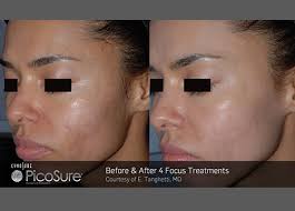 Stretch Mark And Scar Reduction Specialists