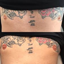 Breast cancer tattoos for men. Areola Nipple Tattooing Is For Everyone Dpc Clinic