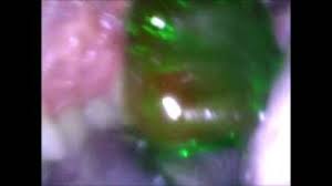 Maybe you would like to learn more about one of these? Jason Mouth Puerto Rico Vlip Lv