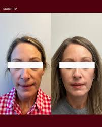 Took some time off from posting but we're back and ready to show you what  we've been up to 😍 First round of her treatment plan is done and the  results are