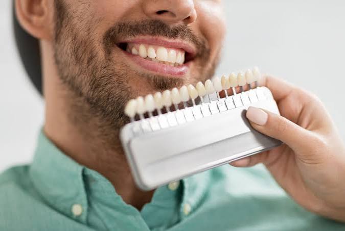 Porcelain Veneers & Lumineers | Waco, TX | Cosmetic Dentistry