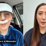 Ju Massaoka Recovers After Unauthorized PMMA Injection in Nose Surgery