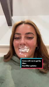 My lips rn are a big bloody slay #fyp #duet #lipfiller #russianlips