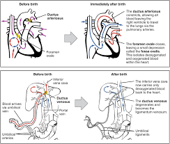 Pin By Berkeley Faye On Maternity Neonatal Nurse Circulatory System Pediatric Patients
