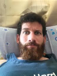 Problems with spirit gum for beard and mustache?