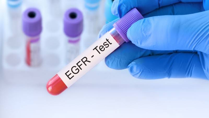 EGFR product image