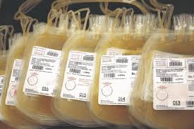 Image result for Platelet Transfusion