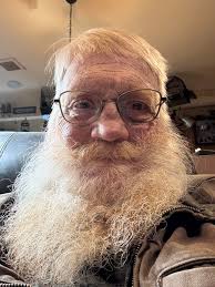 Since we are coming up