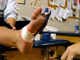 Pain in the region of your big toe? Turf Toe Physiotherapy