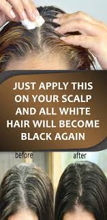 Just Apply This On Your Scalp And All White Hair Will Become Black Again Hair Health White Hair Hair Groth